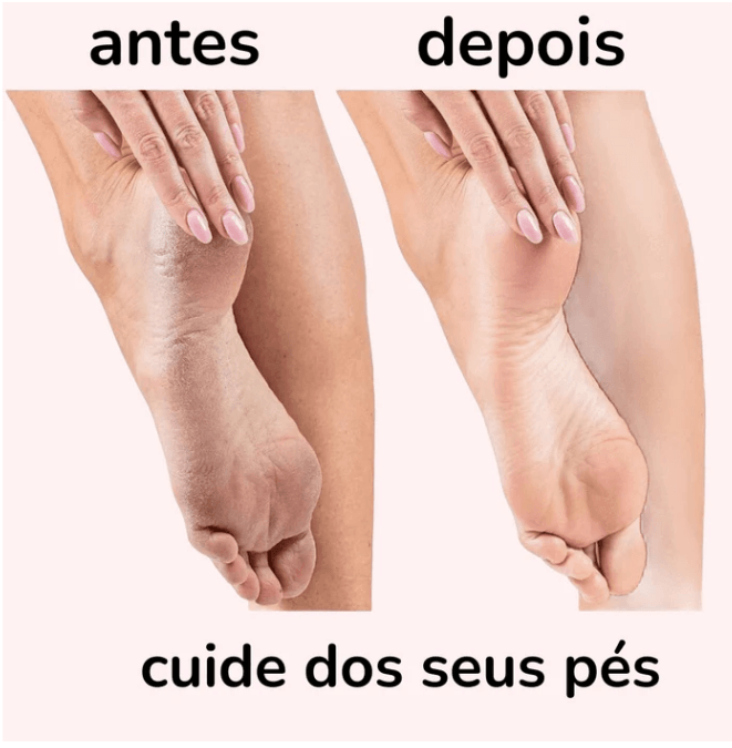 Lixadeira elétrica (''FLAWLESS PED'')